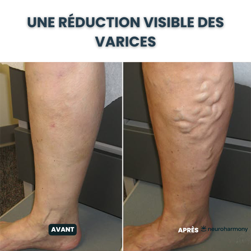 Neuroharmony Nerve Support